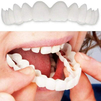 facetas dentárias Natural Removível (Superior e Inferior)