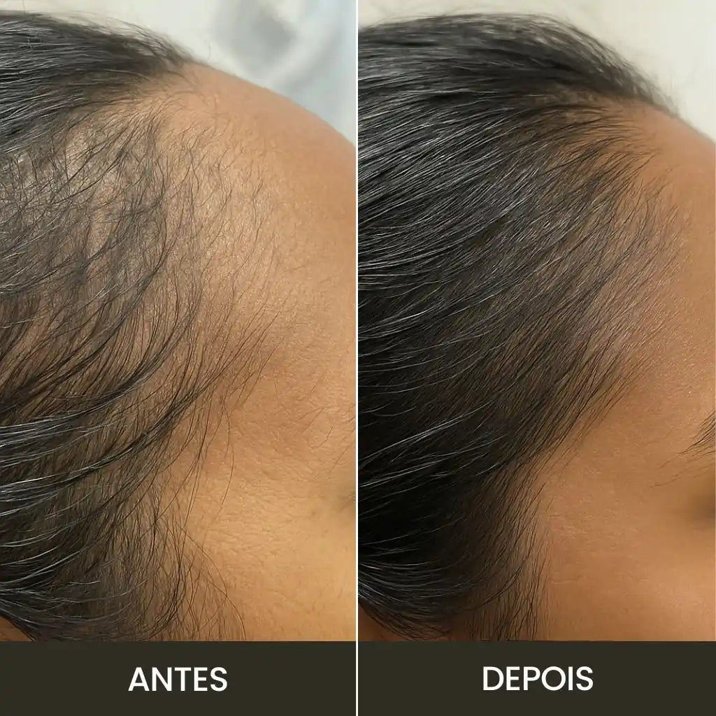 Haartherapiebürste: TheraBrush Smarts 4-in-1